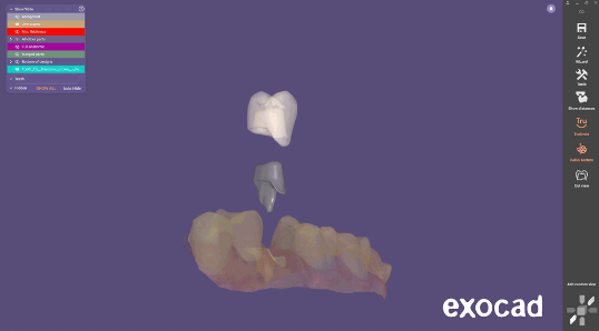 Post and Core Elefsina